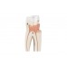 model zęba trzonowego górnego trójkorzeniowego, 3 części - 1017580 [d10/5] 3b scientific modele anatomiczne 5